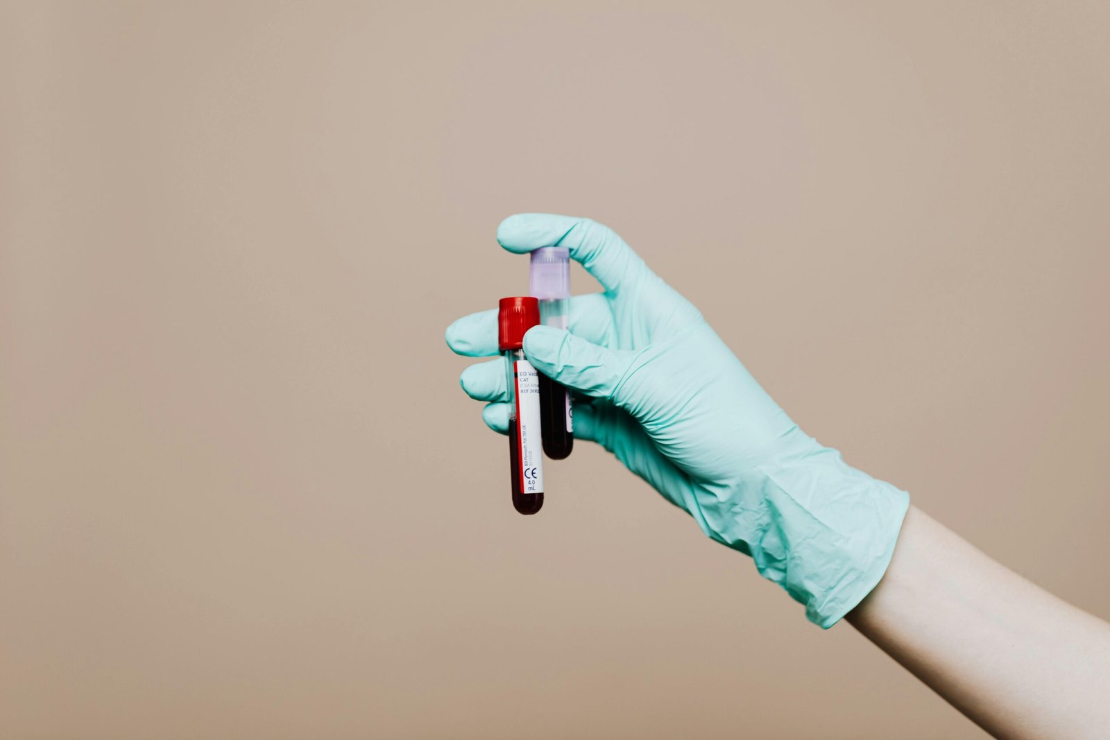 Close-up of a gloved hand holding blood test tubes against neutral background.